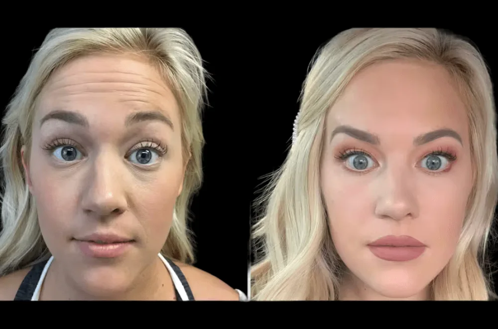 Skincare for Every Season Tips from the Best Aesthetic Clinic in Dubai