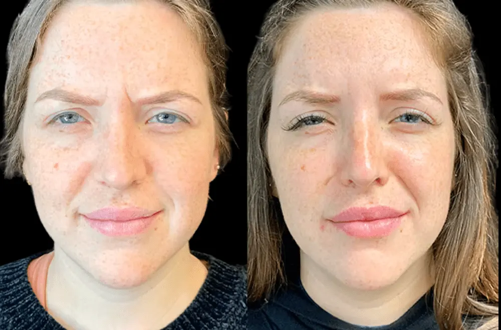 Discover the Best Doctors in Dubai for Botox and Skin Rejuvenation