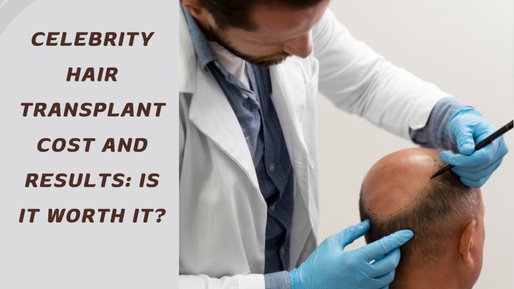 Celebrity Hair Transplant Cost and Results: Is It Worth It?