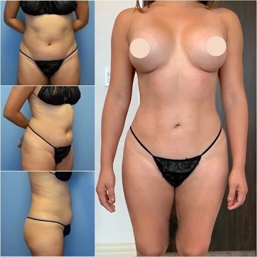 Leading Dubai Aesthetic Best Doctors in Dubai for Body Definition and Contouring