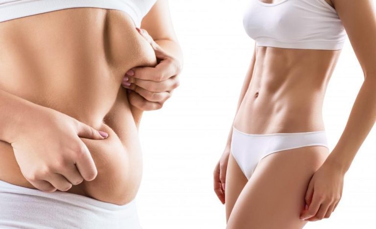 How Liposuction in Dubai Delivers Long-Lasting Body Contouring