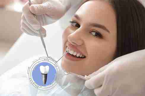 How Implant Surface Chemistry Impacts Tooth Crown Longevity