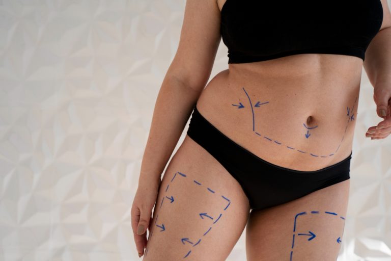 What to Look for in a Surgeon Offering Liposuction in Dubai